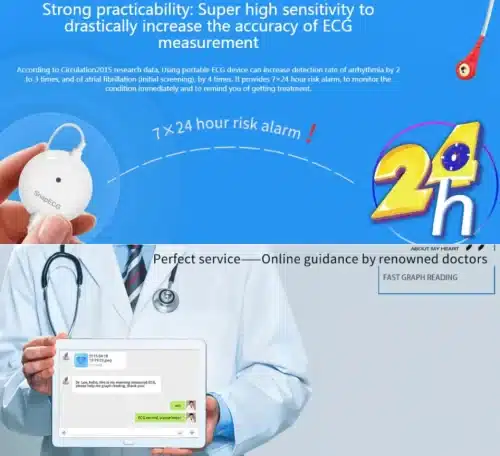 Pelvifine Portable Mini Wearable electrocardiogram ECG Monitor