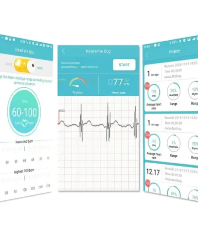 Pelvifine Portable Mini Wearable electrocardiogram ECG Monitor